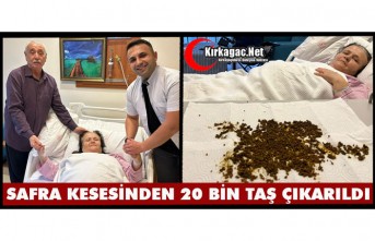 SAFRA KESESİNDEN 20 BİNİN ÜZERİNDE TAŞ ÇIKARILDI
